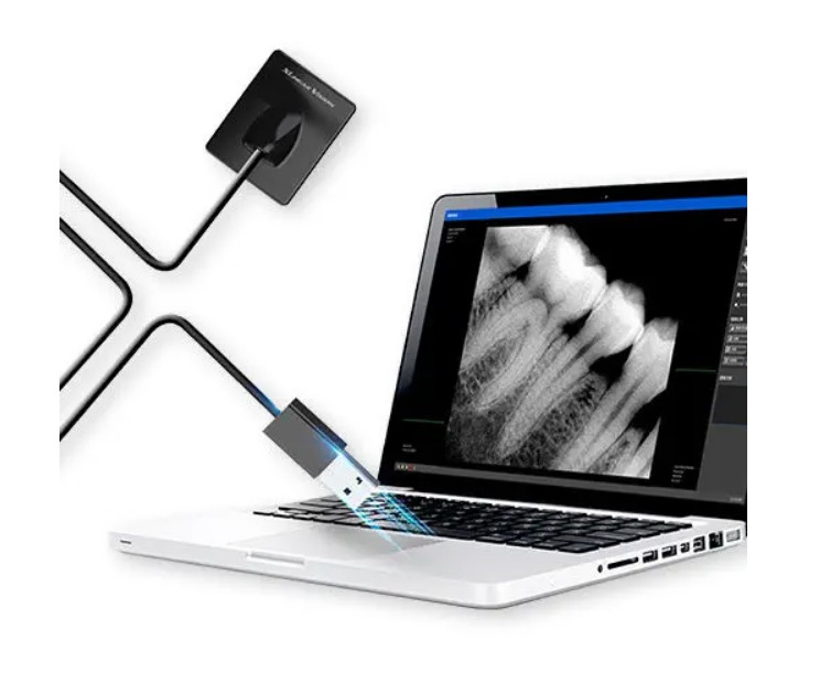 Sensor Intraoral Digital RVG